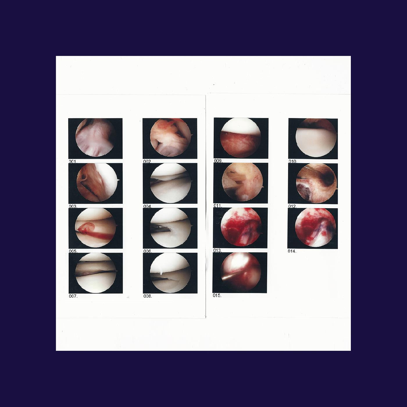 Cradle, The - Laughing In My Sleep (CD) |-